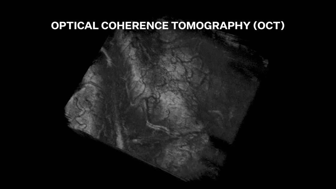 3D-Volumenrendering der Hirnoberfläche aus optischer Kohärenztomographie, Titel Optical Coherence Tomography OCT